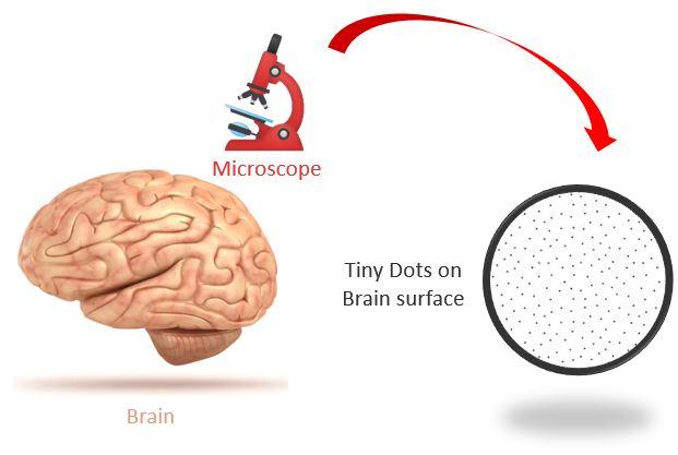 Tiny Dots in Brain
